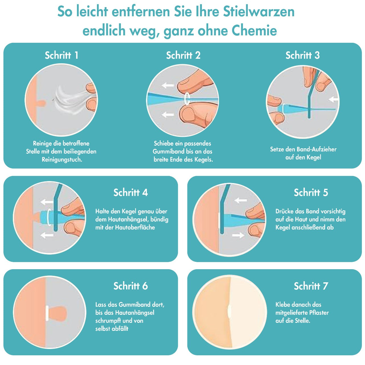 Stielwarzen Entferner โ Stielwarzen selbst entfernen -  Wirksam, Sicher & Einfach ohne Chemie