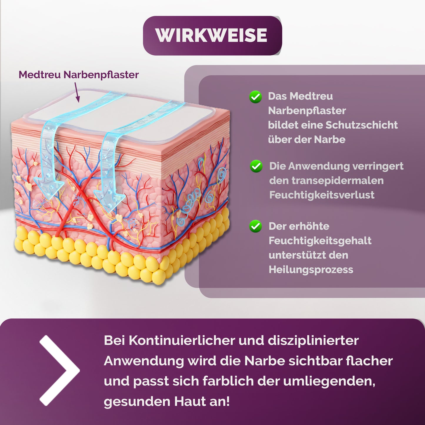 Silikon Narbenpflaster beige