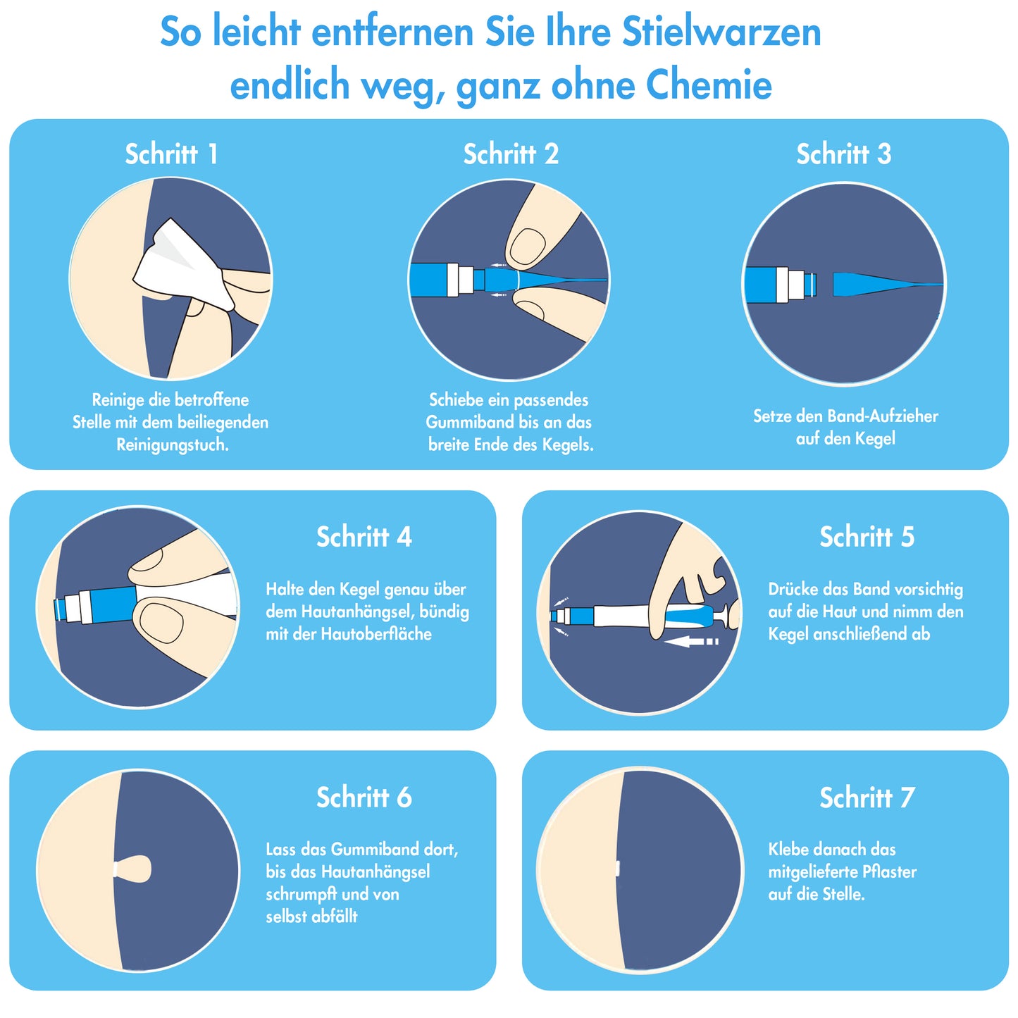 Stielwarzen Entferner Set - einfache Anwendung zu Hause