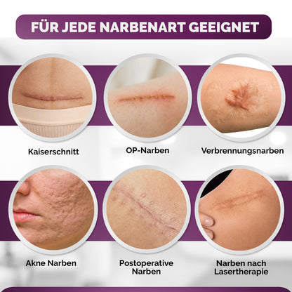 Silikon Narbenpflaster 4x300cm - UV-beständig und Wiederverwendbar