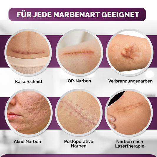 Silikon Narbenpflaster beige