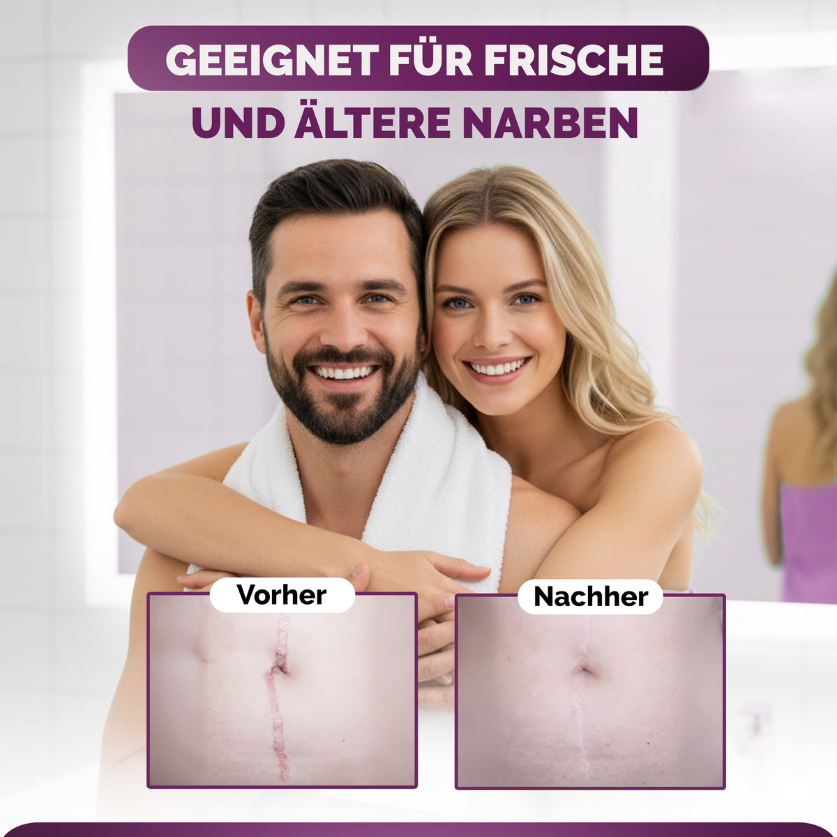 Silikon Narbenpflaster transparent (MedTreu) – Bild 4 von 7