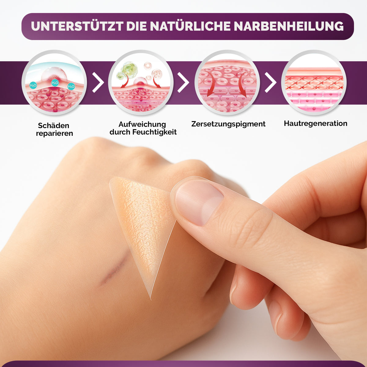 Silikon Narbenpflaster beige (MedTreu) – Bild 6 von 7