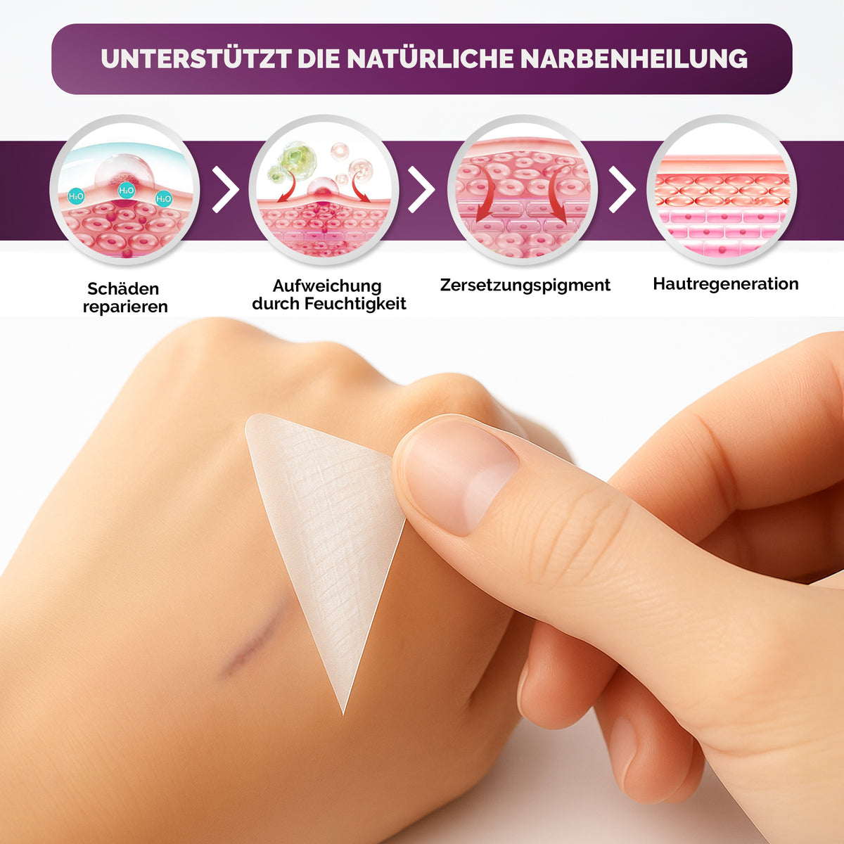 Silikon Narbenpflaster transparent (MedTreu) – Bild 5 von 7
