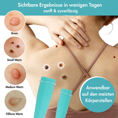 Stielwarzen Entferner – Stielwarzen selbst entfernen -  Wirksam, Sicher & Einfach ohne Chemie