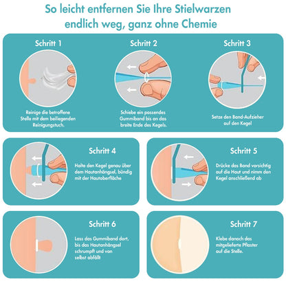 Stielwarzen Entferner – Stielwarzen selbst entfernen -  Wirksam, Sicher & Einfach ohne Chemie
