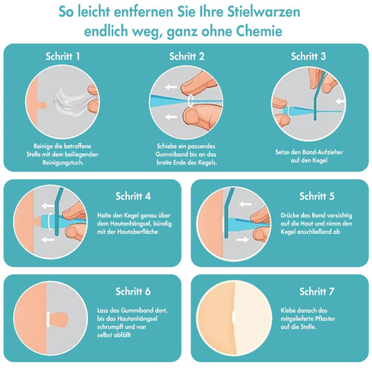 Stielwarzen Entferner