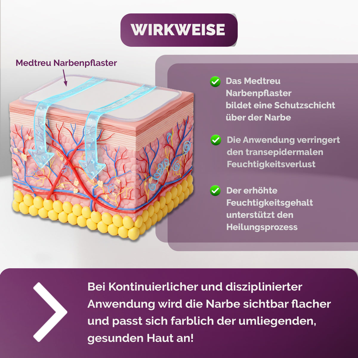 Silikon Narbenpflaster transparent (MedTreu) – Bild 7 von 7
