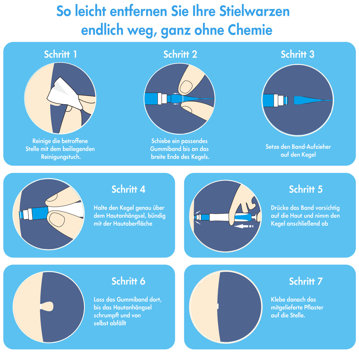 Stielwarzen Entferner Set (für große Warzen)